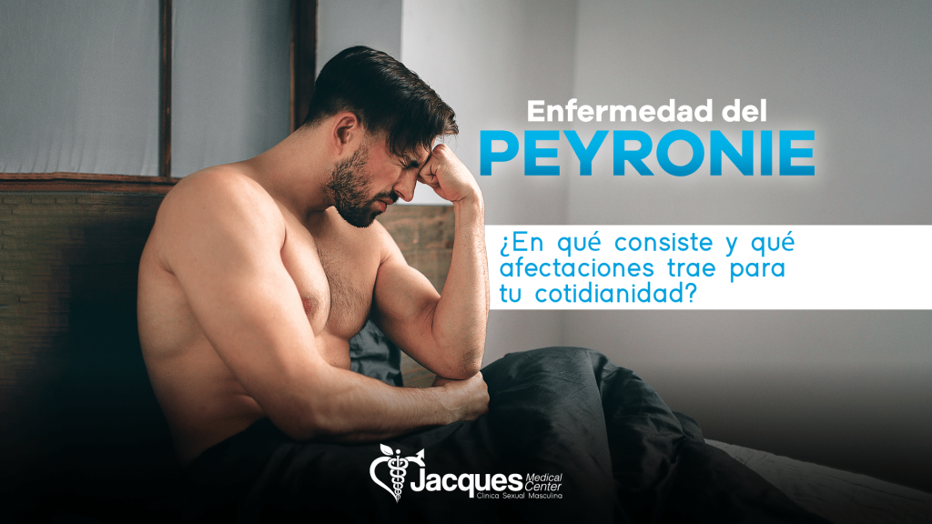 Enfermedad del Peyronie, ¿En qué consiste y qué afectaciones trae para tu cotidianidad_